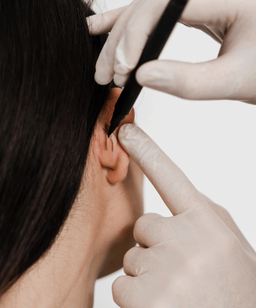 servicos-otoplastia-xpert